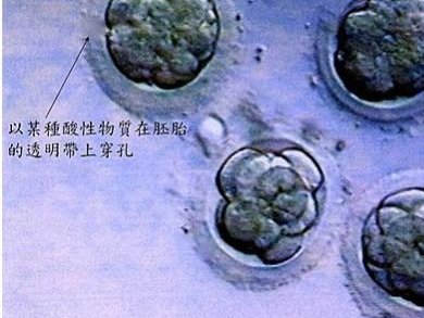 百色做试管婴儿需要多少钱(试管后快速恢复的方法有哪些)